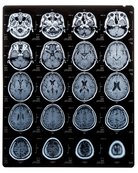 MRI x-ray film scanning  in oxford uk